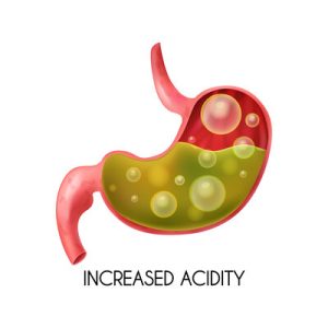 Reflux Gastro-Œsophagien